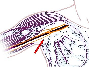 Plexus brachialis Zeichnung